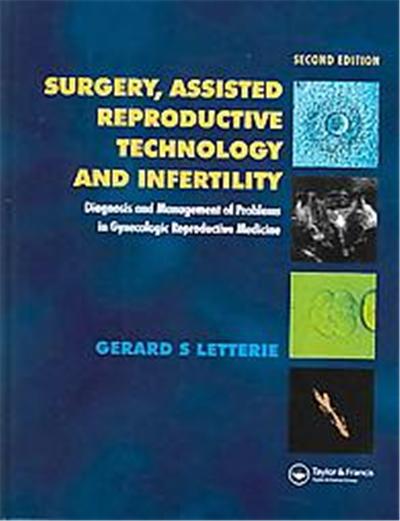 Surgery and Assisted Reproductive Technologies and Infertility