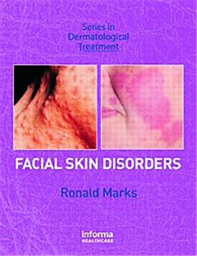 Facial Skin Disorders, Series in Dermatological Treatment