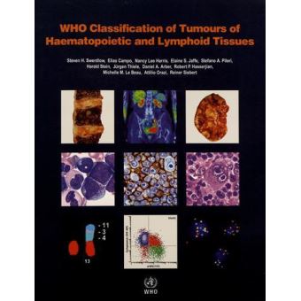 WHO classification of tumours of haematopoietic and lymphoid tissues ...