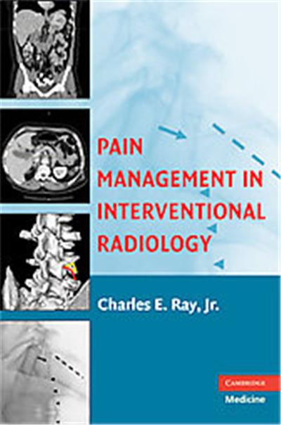 Pain Management in Interventional Radiology