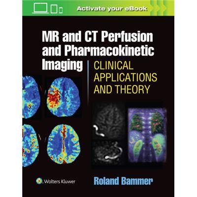 Mr And Ct Perfusion And Pharmacokinetic Imaging: Clinical Applications And Theoretical Principles (Hardcover)