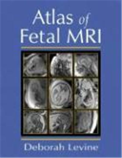 Atlas of Fetal MRI