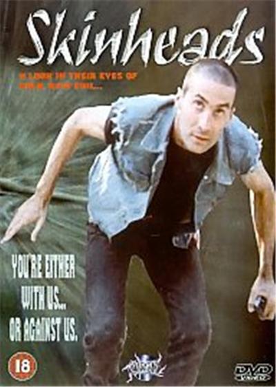 Skinheads