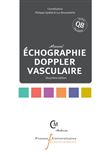 Echographie doppler vasculaire