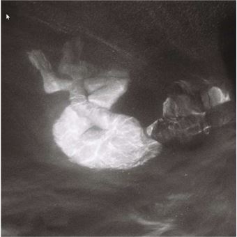 Alice Phoebe Lou - 1