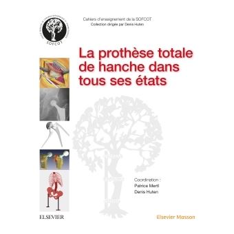 La prothèse totale de hanche dans tous ses états