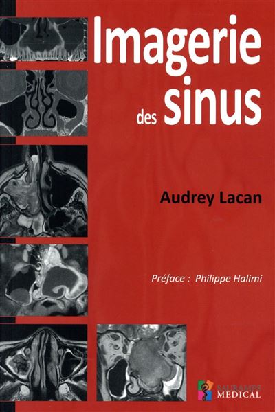 Imagerie des sinus