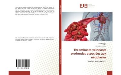 Thromboses veineuses profondes associees aux neoplasies