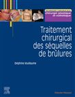 Traitement chirurgical des séquelles des brûlures