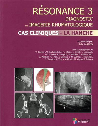 Resonance 3 cas cliniques- la hanche