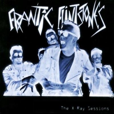 The x ray sessions