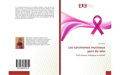 Les carcinomes mucineux purs du sein - profil clinique, biol