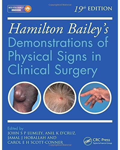 Hamilton Bailey's physical signs