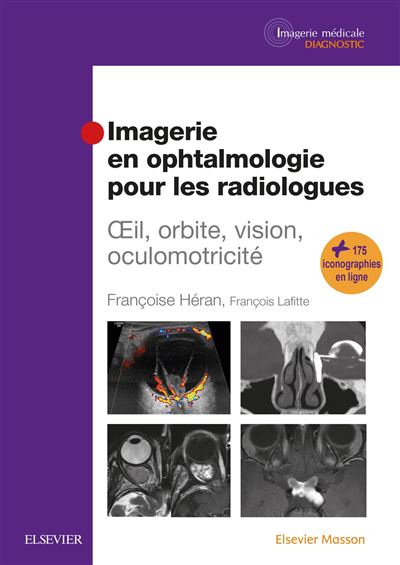 Imagerie en ophtalmologie pour les radiologues - Françoise Héran - cartonné