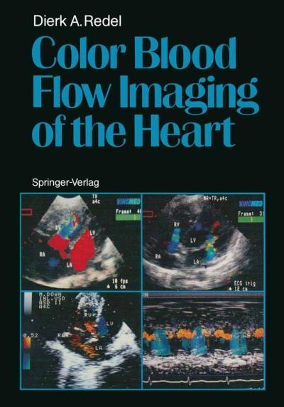 Color blood flow imaging of the heart - Poche - Dierk A. Redel - Achat ...