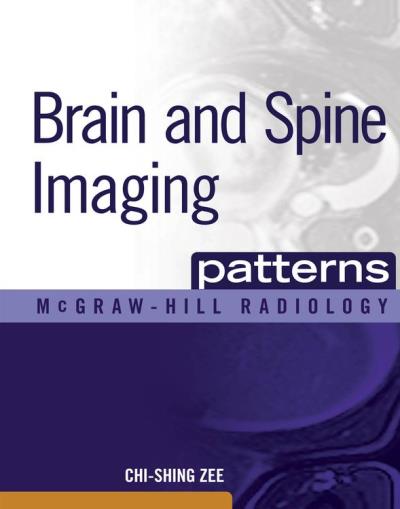 Pimaging Patterns Brain and spine imaging patterns - relié - Chi-Shing Zee - Achat Livre ...