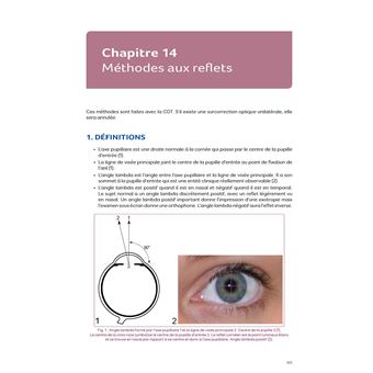 Motricité et sensorialité oculaire : l’examen - 2e ed