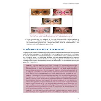 Motricité et sensorialité oculaire : l’examen - 2e ed