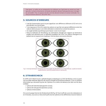 Motricité et sensorialité oculaire : l’examen - 2e ed