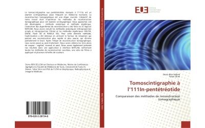 Tomoscintigraphie à l'111In-pentétréotide