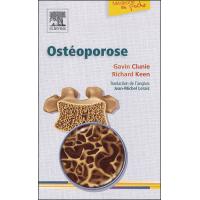 Ostéoporose