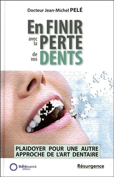 En finir avec la perte de vos dents