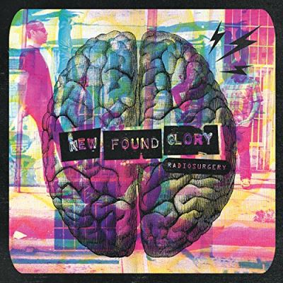 Radiosurgery/inclus cd bonus