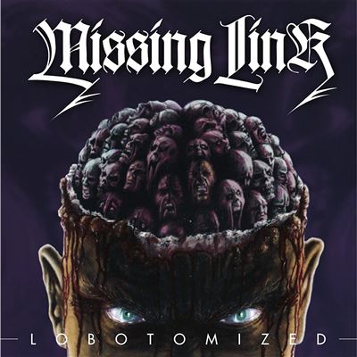 Lobotomized
