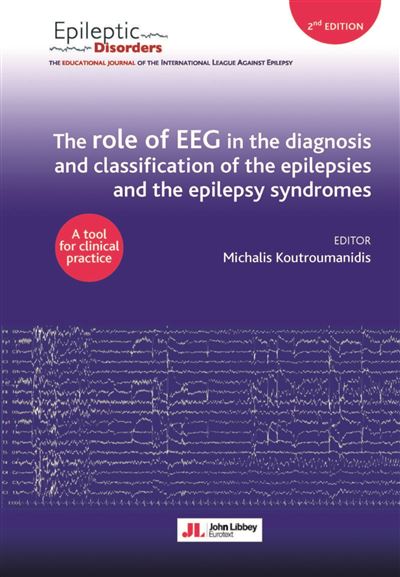 The role of EEG in the diagnosis and classification of the epilepsy syndromes