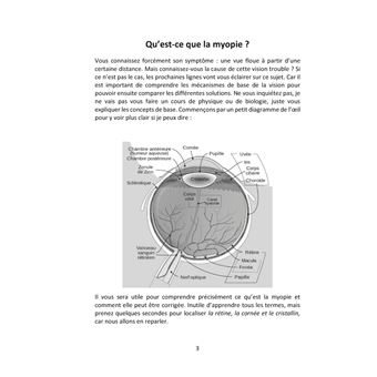 Le guide de la correction de la myopie