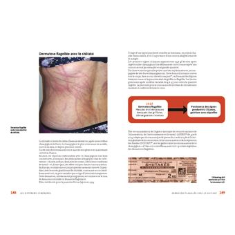 Champignons toxiques