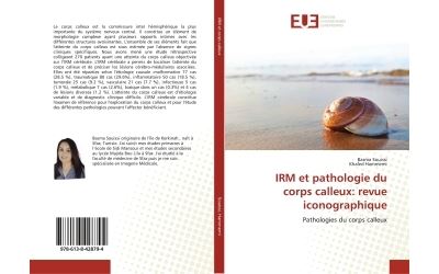 IRM et pathologie du corps calleux: revue iconographique