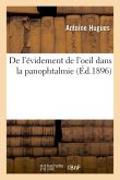 De l'évidement de l'oeil dans la panophtalmie