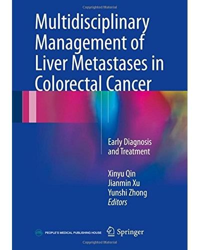 Multidisciplinary management of liver metastases in colorectal cancer