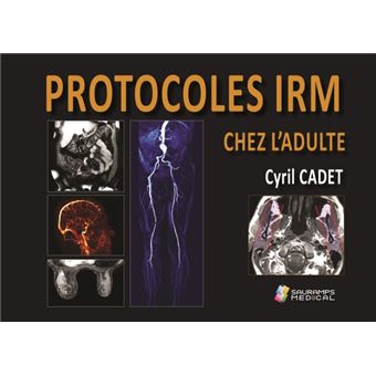 Protocoles IRM chez l'adulte