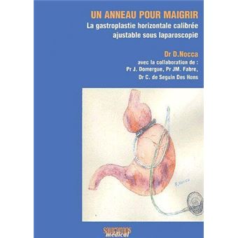 Un anneau pour maigrir