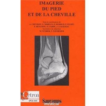 Imagerie du pied et de la cheville monographie du getroa