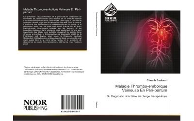 Maladie thrombo-embolique veineuse en peri-partum