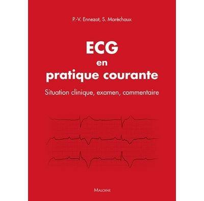 100 ecg en pratique courante situation clinique interpretati