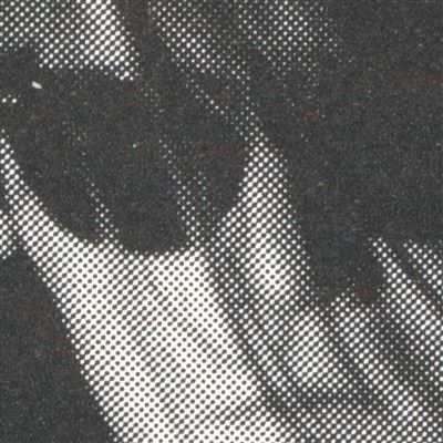 X-ray Eyes