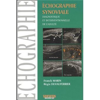 Echographie synoviale diagnostique et interventionnelle de l'adulte