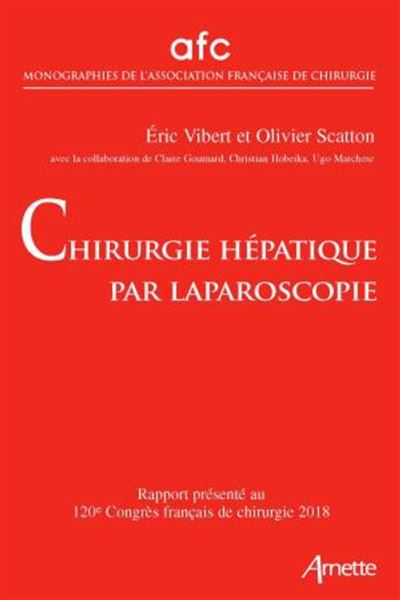 Chirurgie hépatique par laparoscopie - Eric Vibert - broché