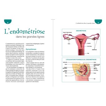 Endométriose & Alimentation - Le régime anti-inflammatoire pour soulager les symptômes