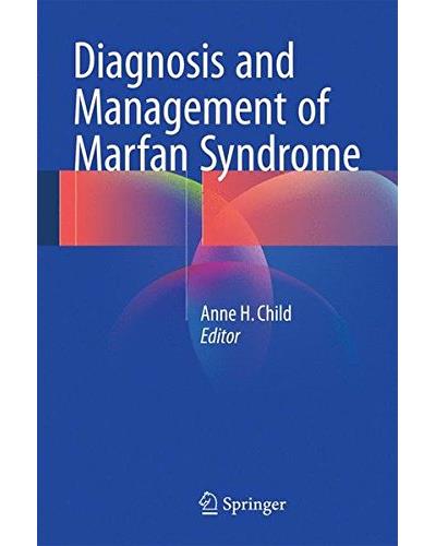 Diagnosis and management of marfan syndrome