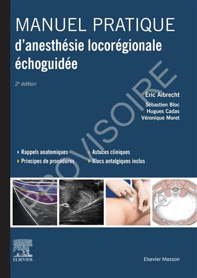 Manuel pratique d’anesthésie locorégionale échoguidée