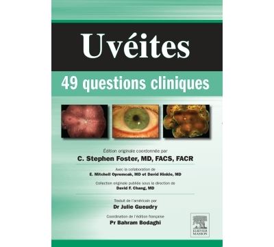 Uveites : 49 questions cliniques