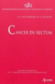 Cancer du rectum