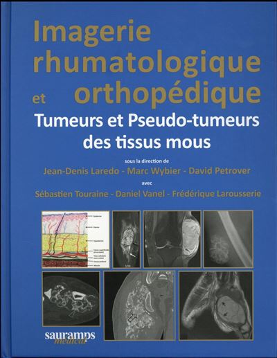 Imagerie rhumatologique et orthopédique tome 5 -tumeurs et pseudo-tumeurs des ti