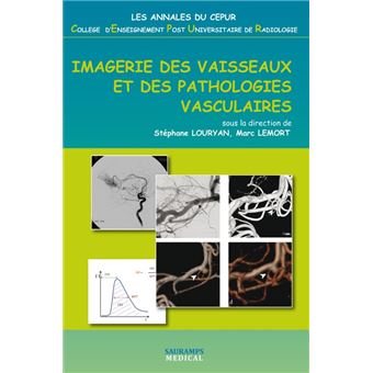 Imagerie des vaisseaux et des pathologies vasculaires broché
