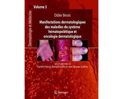 Manifestations dermatologiques des maladies du système hémat